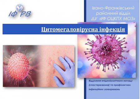 У жителя Івано-Франківська зареєстрований випадок важкої форми цитомегаловірусної інфекції