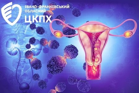 Що таке рак шийки матки?